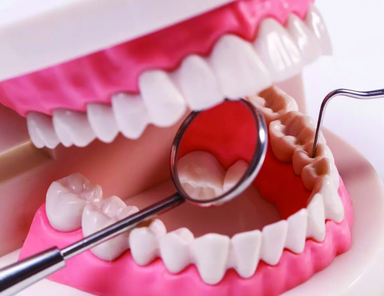 Functional Appliances